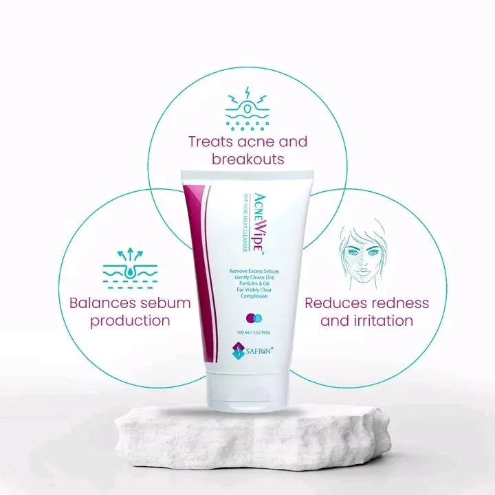 Acnewipe Milky Cleanser for Acne Face
